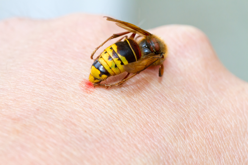 Stinging insects allergy symptoms and treatment 
